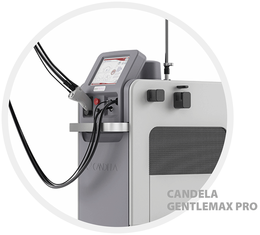 Аппарат для лазерной эпиляции gentlemax